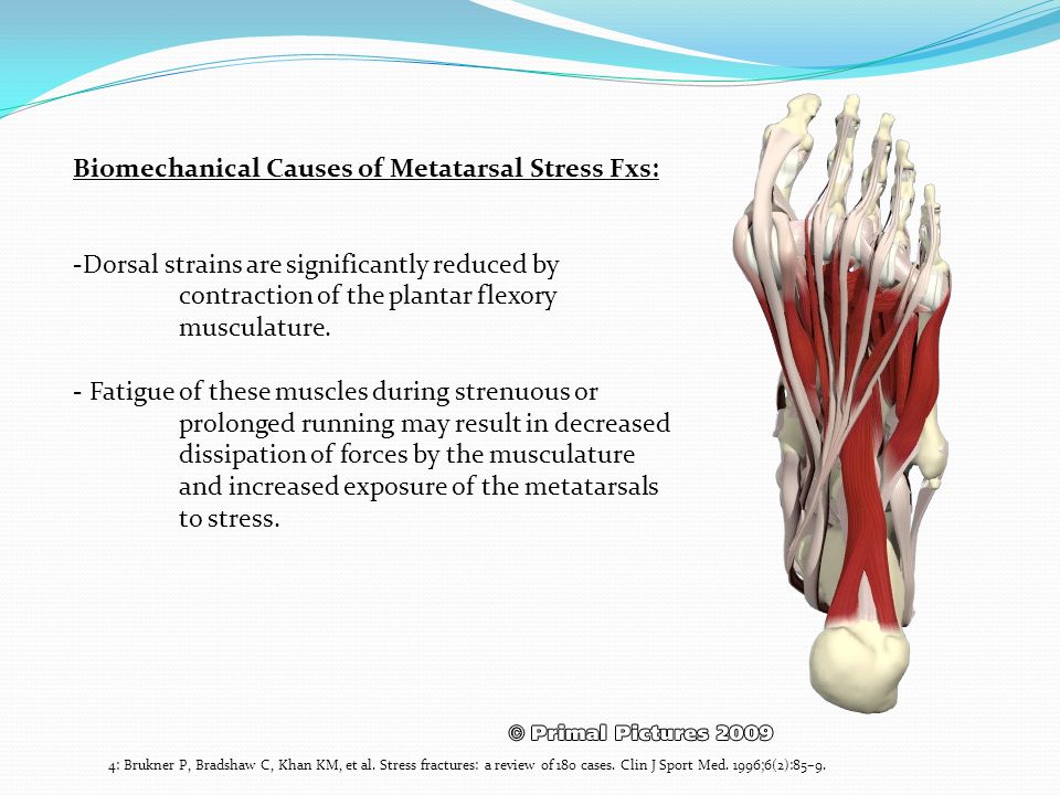 muscle fatigue muscle fatigue