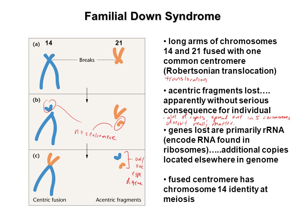 an analysis of cause diagnosis and proper treatment on down syndrome Down syndrome-facts, pictures, symptoms causes of down syndrome the treatment for down syndrome focuses primarily on physiological and psychological therapies. an analysis of cause diagnosis and proper treatment on down syndrome Down syndrome-facts, pictures, symptoms causes of down syndrome the treatment for down syndrome focuses primarily on physiological and psychological therapies.
