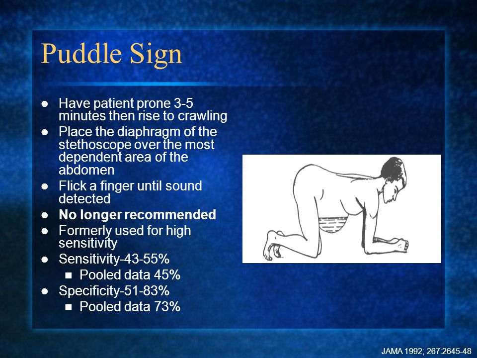 INTERNATIONAL ASCITES CLUB international ascites club: