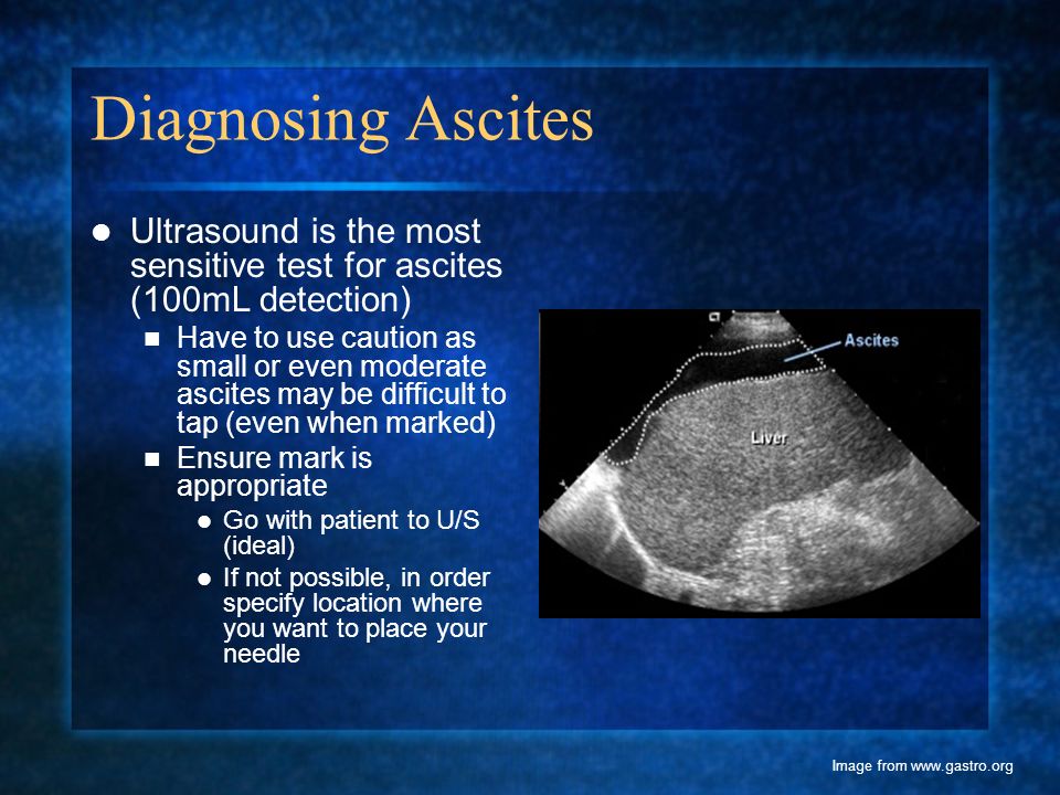 INTERNATIONAL ASCITES CLUB international ascites club: