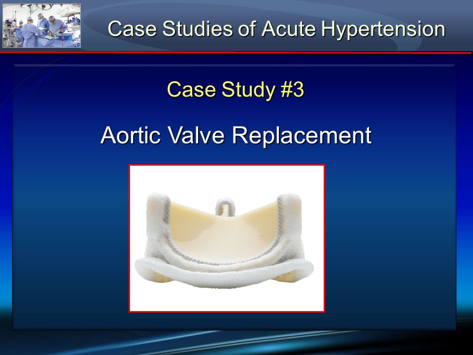 case study of hypertension case study of hypertension