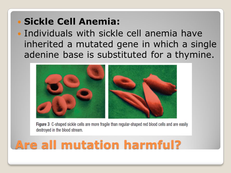 persuasive essay on sickle cell anemia persuasive essay on sickle cell anemia