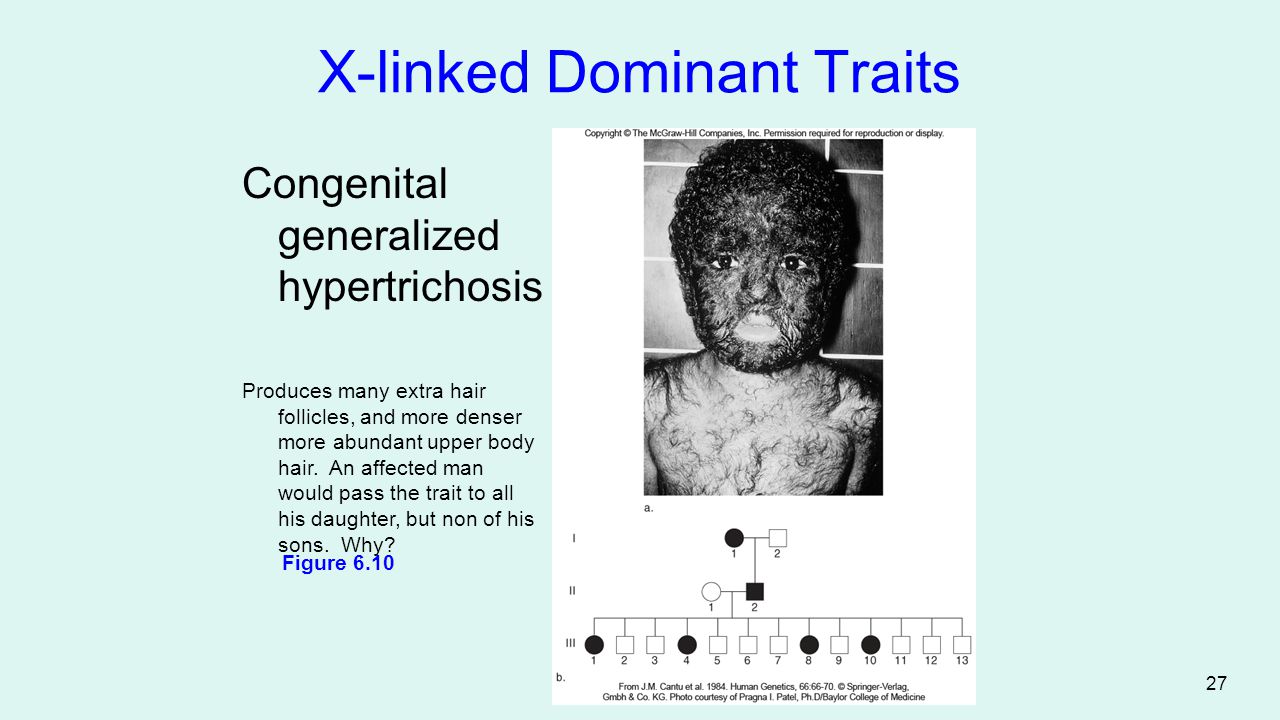 Sex-Limited+Traits+Examples Human Genetics Concepts and Applications Ninth Edition RICKI LEWIS ...