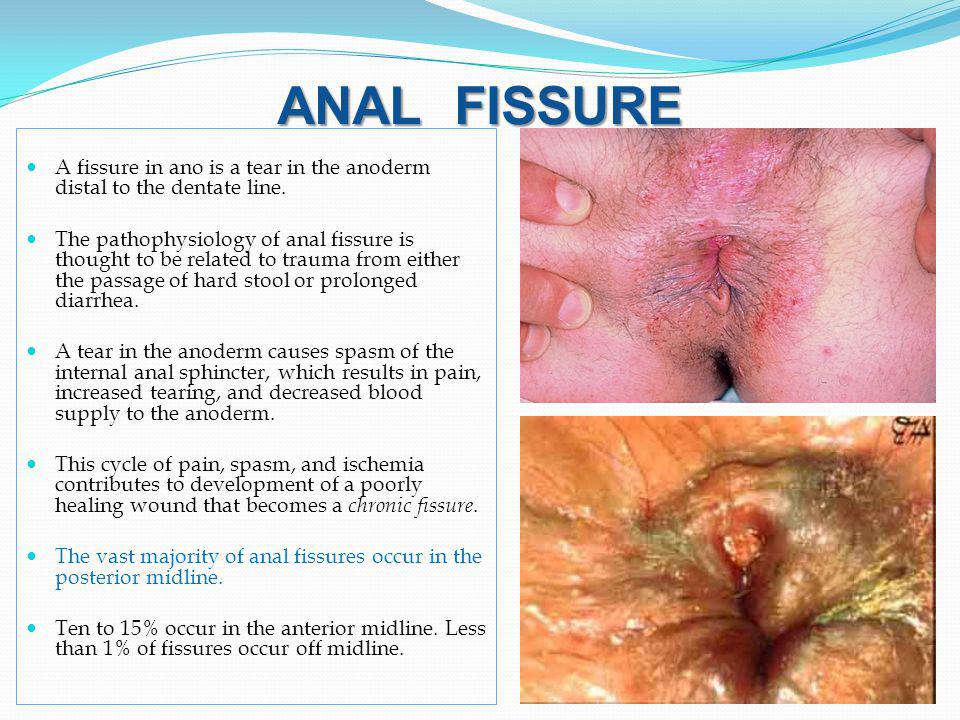 Free amateur twink video site Giant clitoris picture