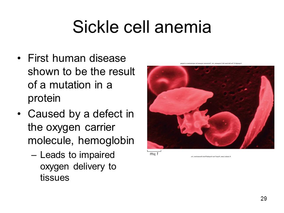 sickle cell anemia research paper sickle cell anemia research paper