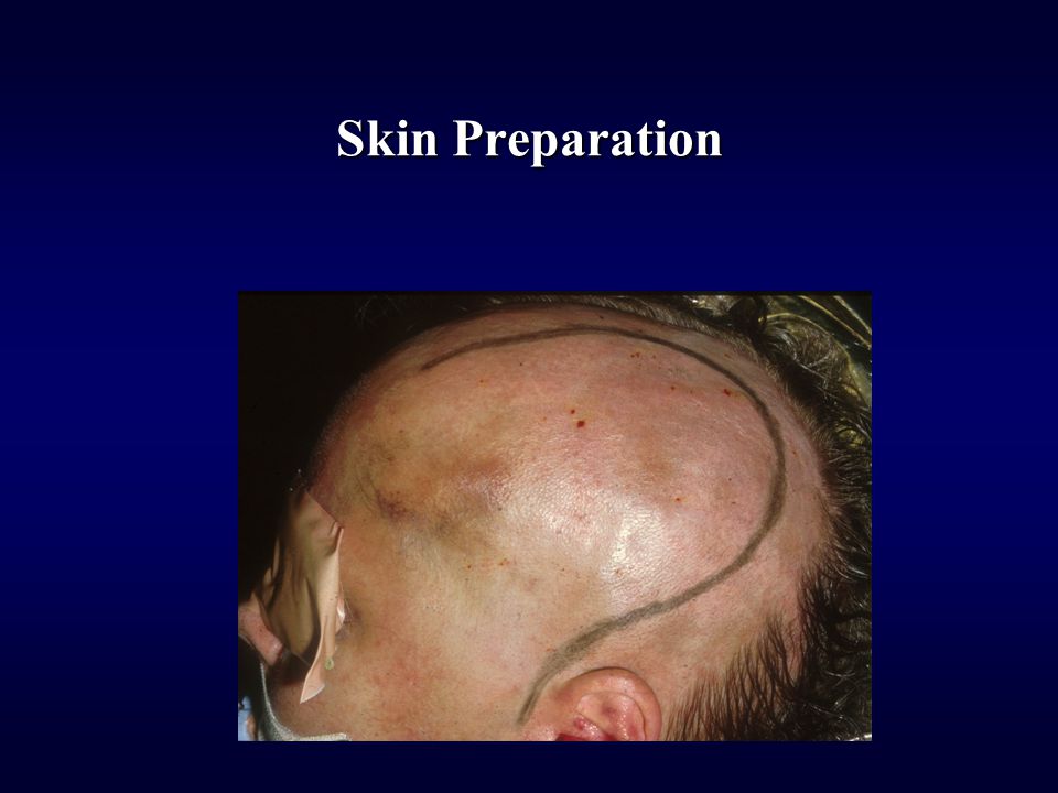 Skin Preparation