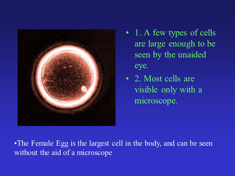 1. A few types of cells are large enough to be seen by the unaided eye.