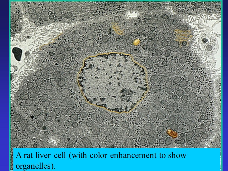 A rat liver cell (with color enhancement to show organelles).
