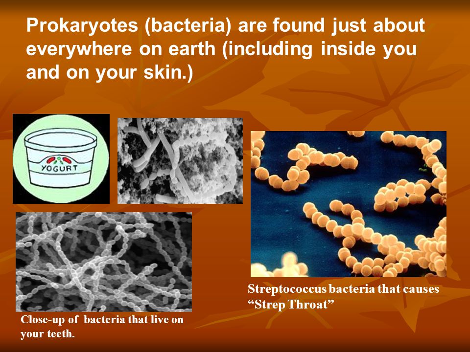 Prokaryotes (bacteria) are found just about everywhere on earth (including inside you and on your skin.) Streptococcus bacteria that causes Strep Throat Close-up of bacteria that live on your teeth.