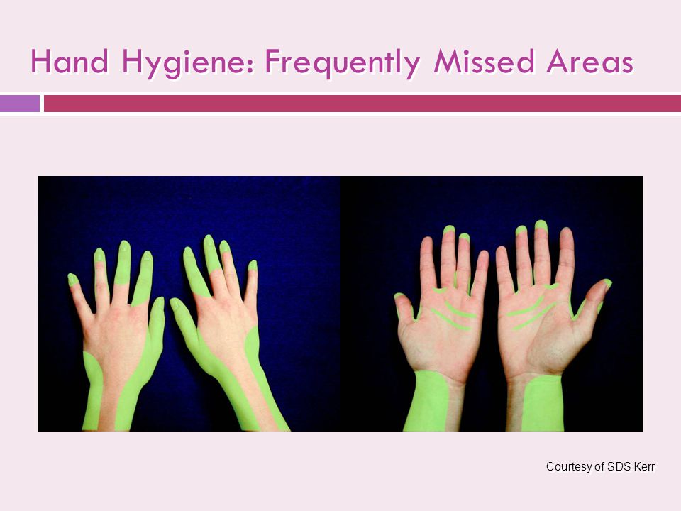 Hand Hygiene: Frequently Missed Areas Courtesy of SDS Kerr