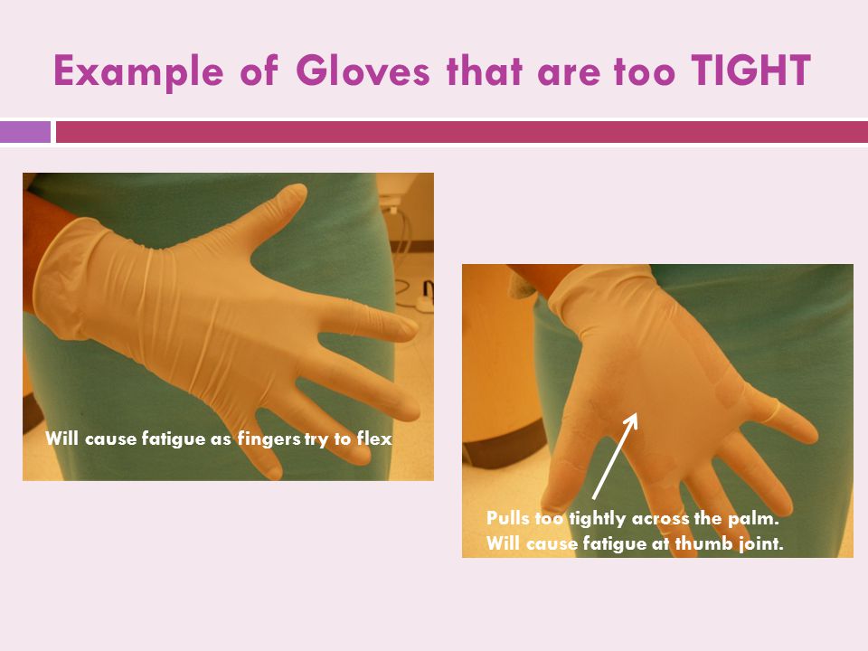 Example of Gloves that are too TIGHT Pulls too tightly across the palm.