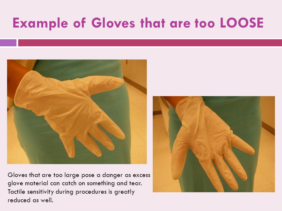 Example of Gloves that are too LOOSE Gloves that are too large pose a danger as excess glove material can catch on something and tear.