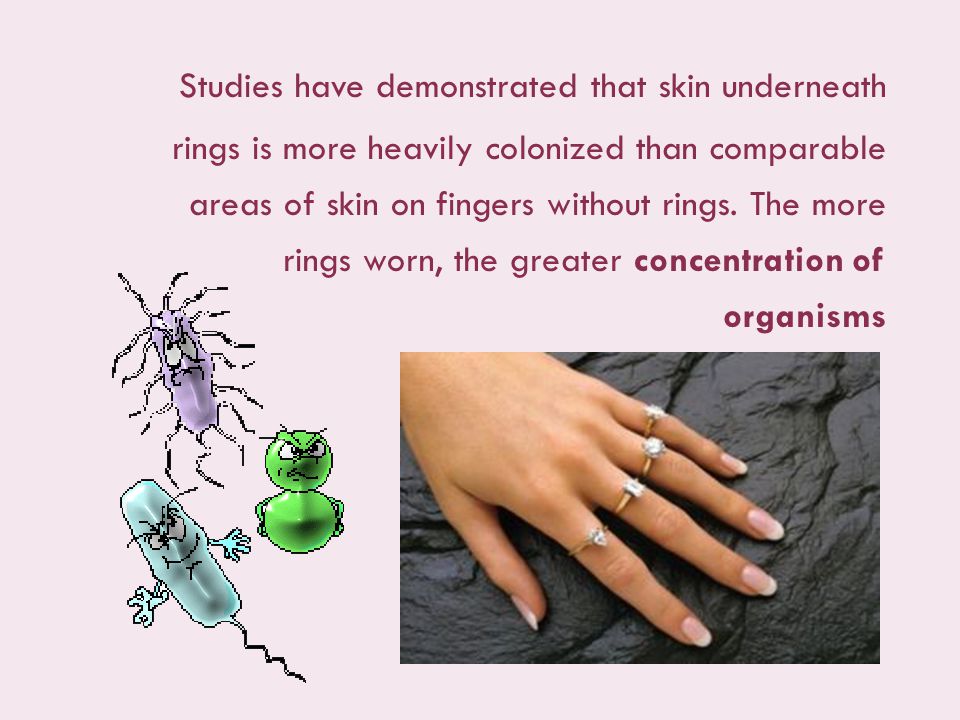 Studies have demonstrated that skin underneath rings is more heavily colonized than comparable areas of skin on fingers without rings.