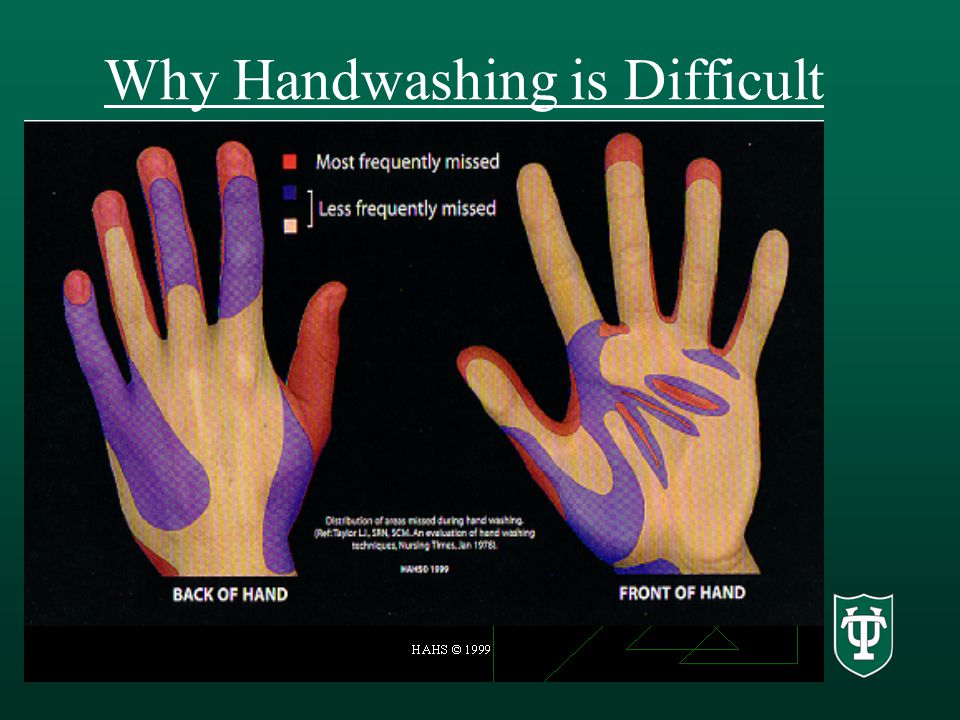 Why Handwashing is Difficult