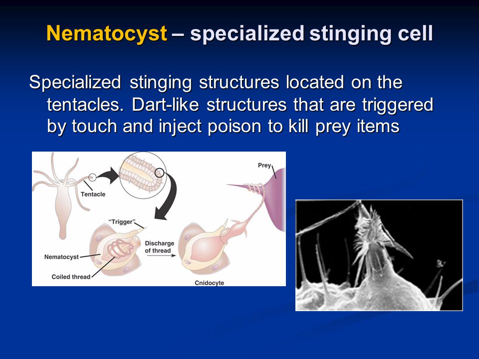 Nematocyst – specialized stinging cell Specialized stinging structures located on the tentacles.