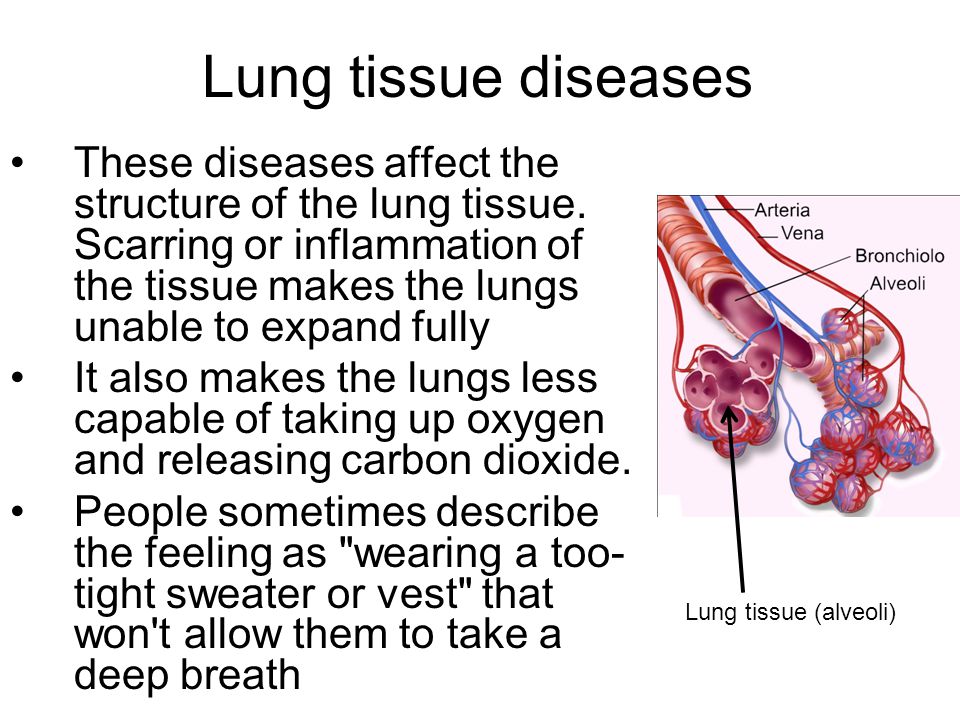 Lung tissue diseases These diseases affect the structure of the lung tissue.