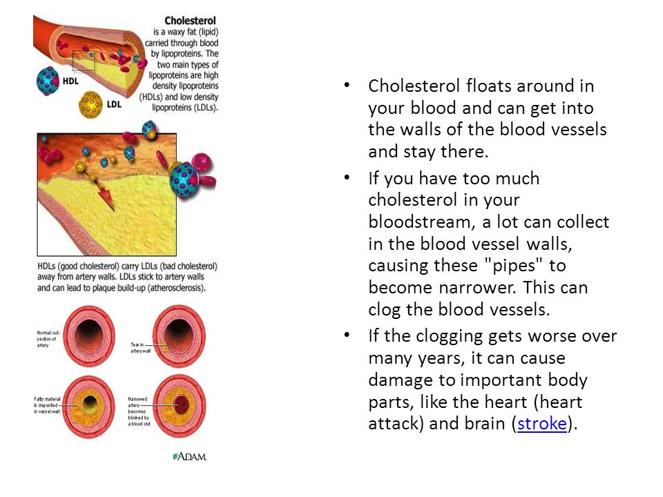 Cholesterol floats around in your blood and can get into the walls of the blood vessels and stay there.