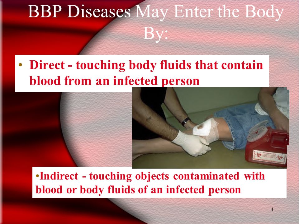3 Definitions The most common BBP diseases are: –HIV (AIDS) –HBV (Hepatitis B) –Meningitis –Tuberculosis 15