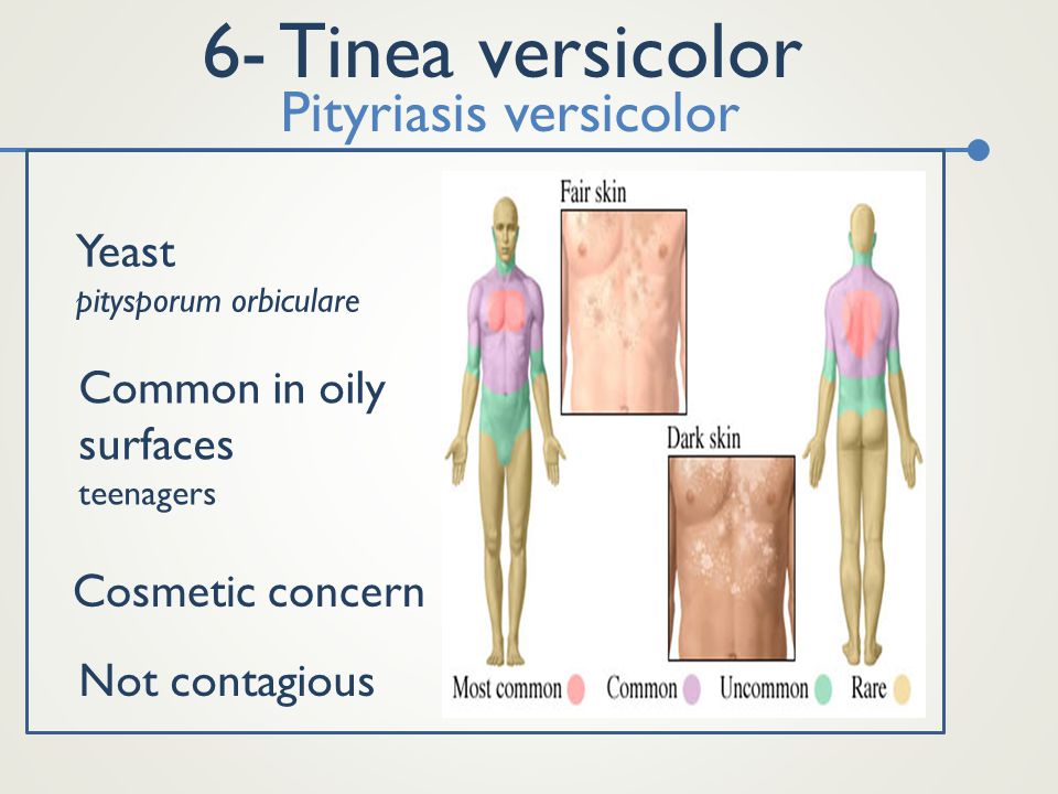 plavix kidney function plavix kidney function
