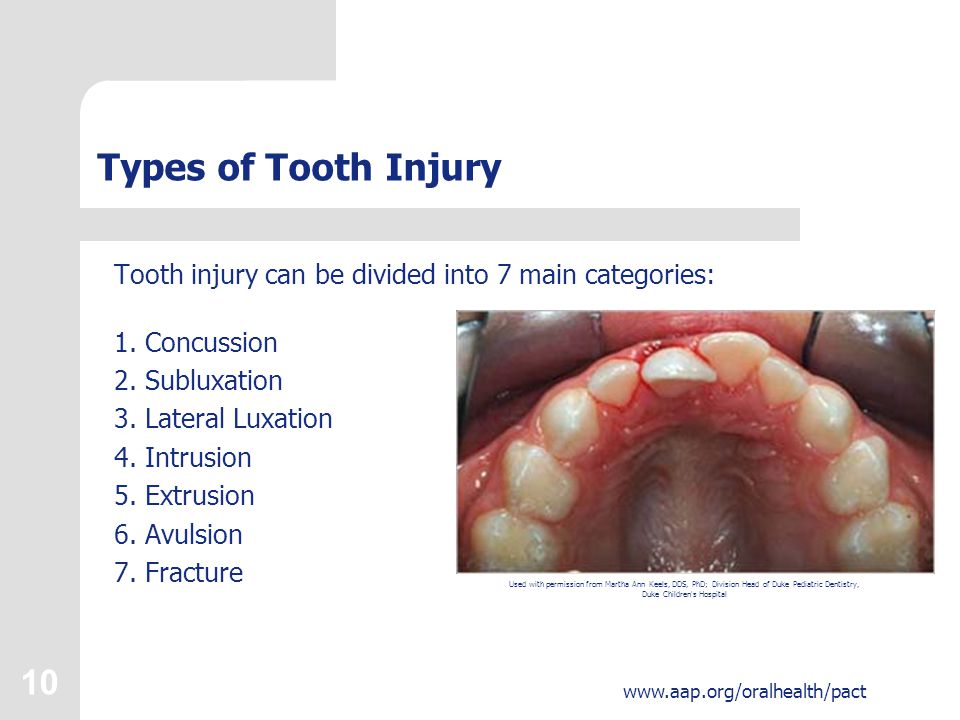 tooth luxation