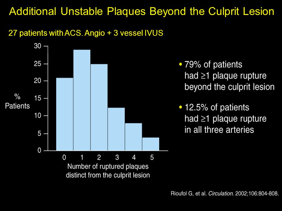 Additional Unstable Plaques Beyond the Culprit Lesion 27 patients with ACS. Angio + 3 vessel IVUS