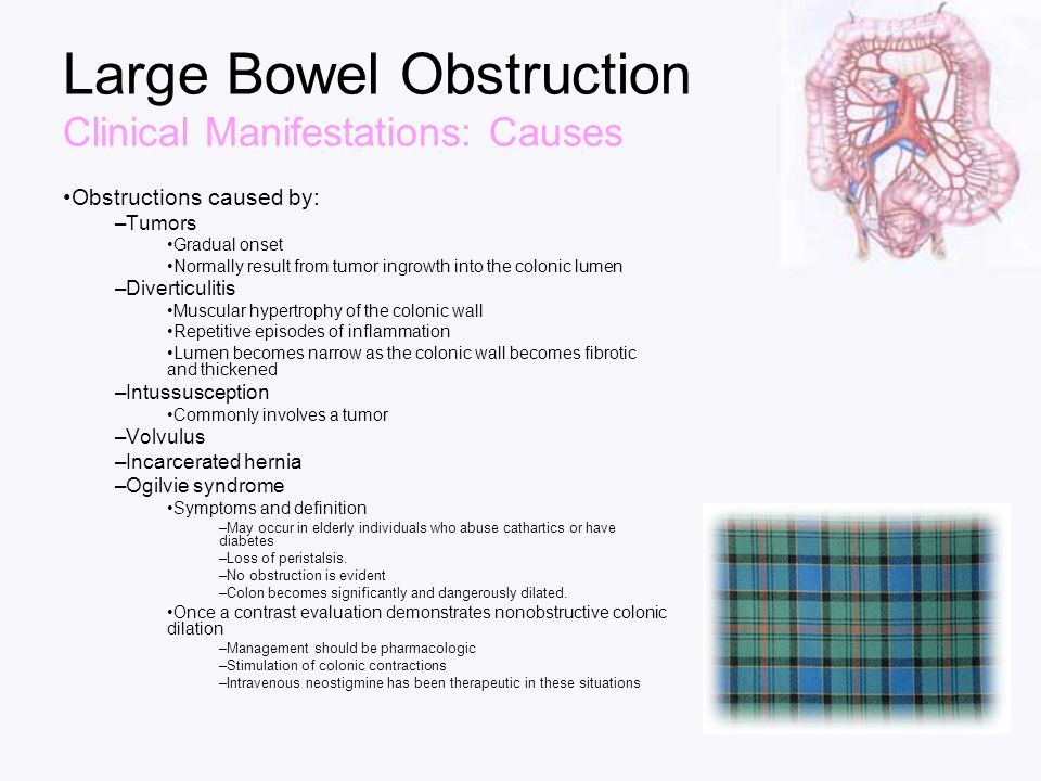 bowel obstruction Find out about small bowel obstructions (sbo) from the cleveland clinic, including information on symptoms, treatments, diagnosis & more. bowel obstruction Find out about small bowel obstructions (sbo) from the cleveland clinic, including information on symptoms, treatments, diagnosis & more.