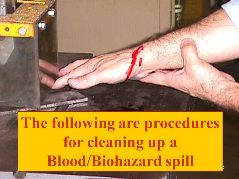 The following are procedures for cleaning up a Blood/Biohazard spill 15