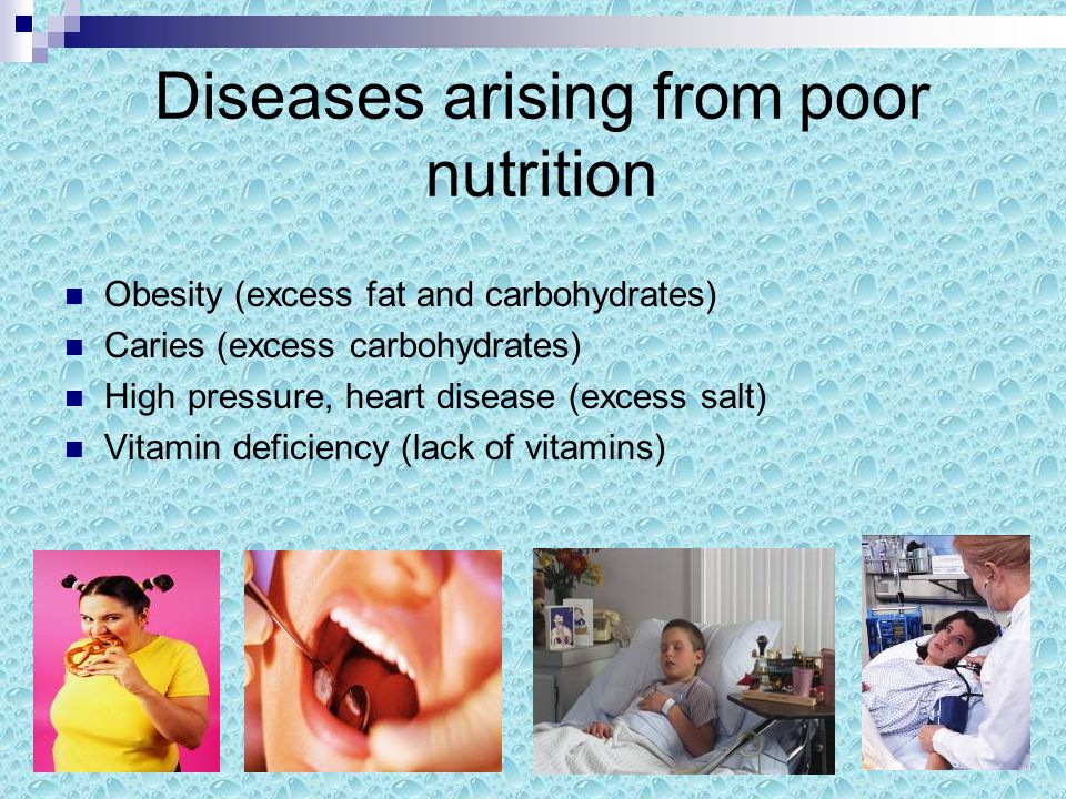 Diseases arising from poor nutrition Obesity (excess fat and carbohydrates) Caries (excess carbohydrates) High pressure, heart disease (excess salt) Vitamin deficiency (lack of vitamins)