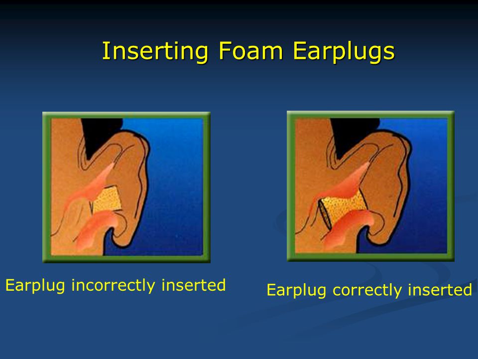 Inserting Foam Earplugs Earplug incorrectly inserted Earplug correctly inserted