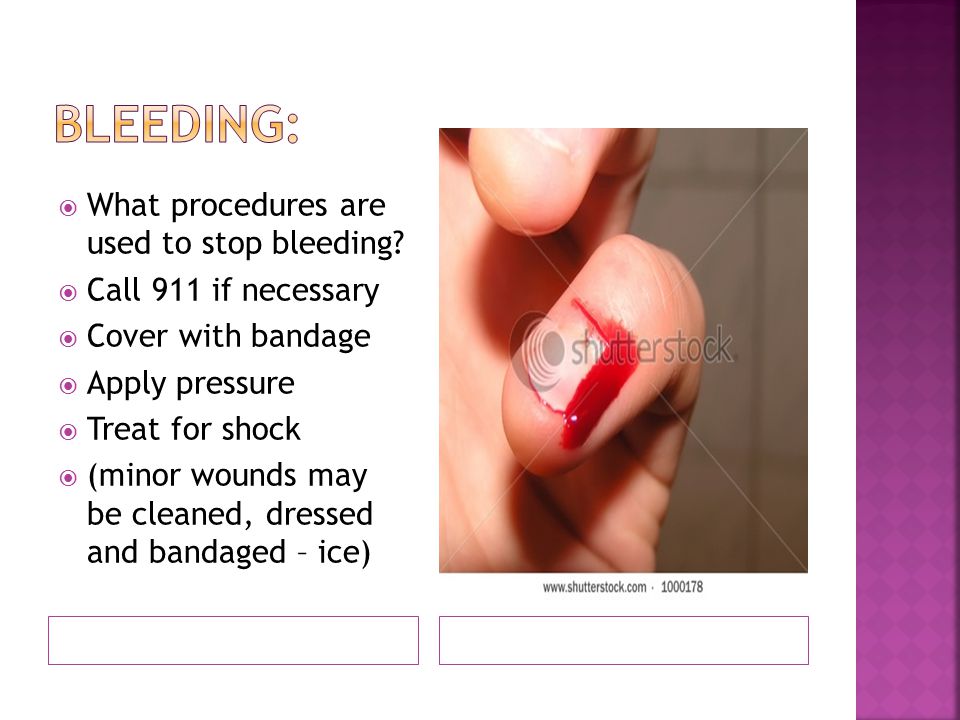  What procedures are used to stop bleeding.