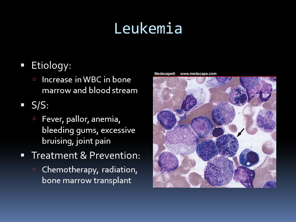 Leukemia  Etiology:  Increase in WBC in bone marrow and blood stream  S/S:  Fever, pallor, anemia, bleeding gums, excessive bruising, joint pain  Treatment & Prevention:  Chemotherapy, radiation, bone marrow transplant