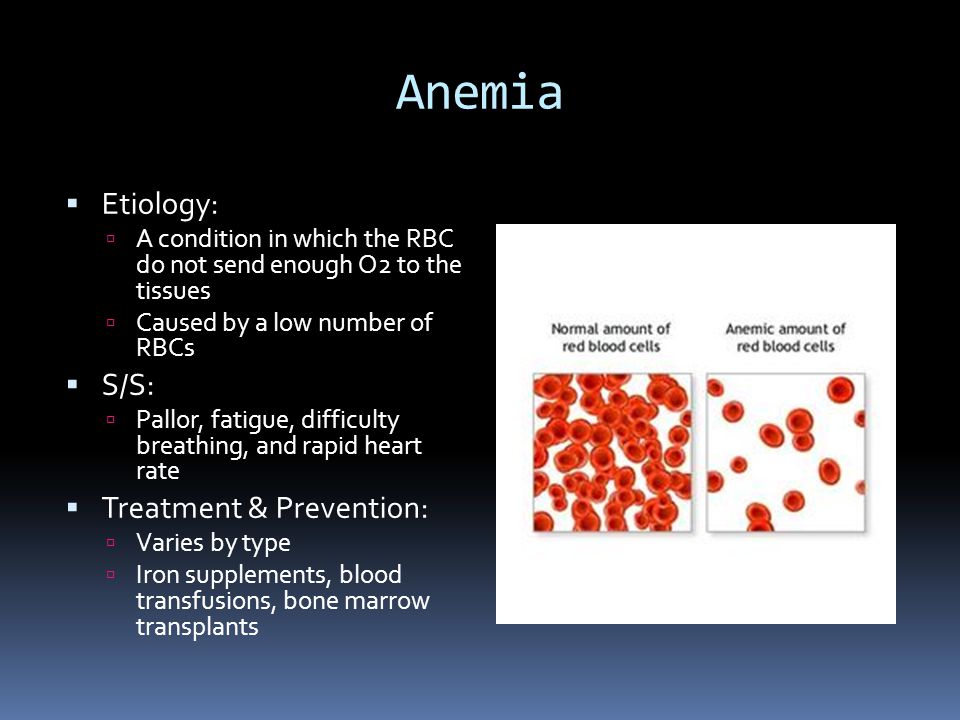 Anemia  Etiology:  A condition in which the RBC do not send enough O2 to the tissues  Caused by a low number of RBCs  S/S:  Pallor, fatigue, difficulty breathing, and rapid heart rate  Treatment & Prevention:  Varies by type  Iron supplements, blood transfusions, bone marrow transplants