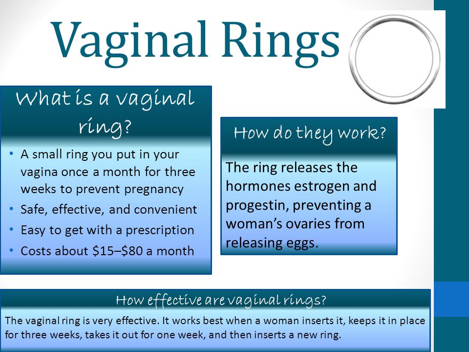 Vaginal Rings A small ring you put in your vagina once a month for three weeks to prevent pregnancy Safe, effective, and convenient Easy to get with a prescription Costs about $15–$80 a month The ring releases the hormones estrogen and progestin, preventing a woman’s ovaries from releasing eggs.