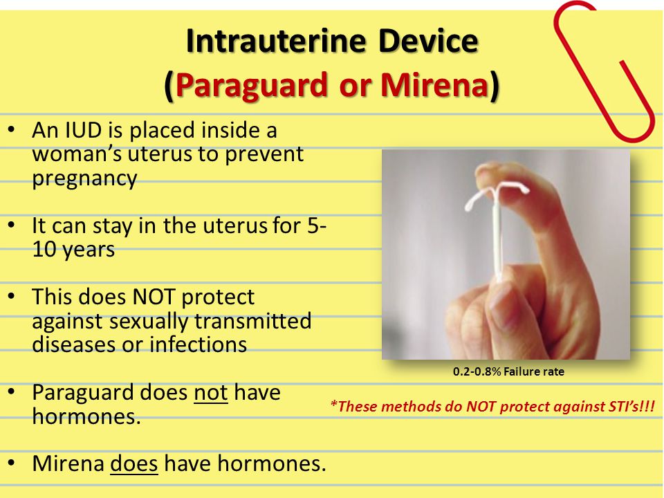 Intrauterine Device (Paraguard or Mirena) An IUD is placed inside a woman’s uterus to prevent pregnancy It can stay in the uterus for years This does NOT protect against sexually transmitted diseases or infections Paraguard does not have hormones.