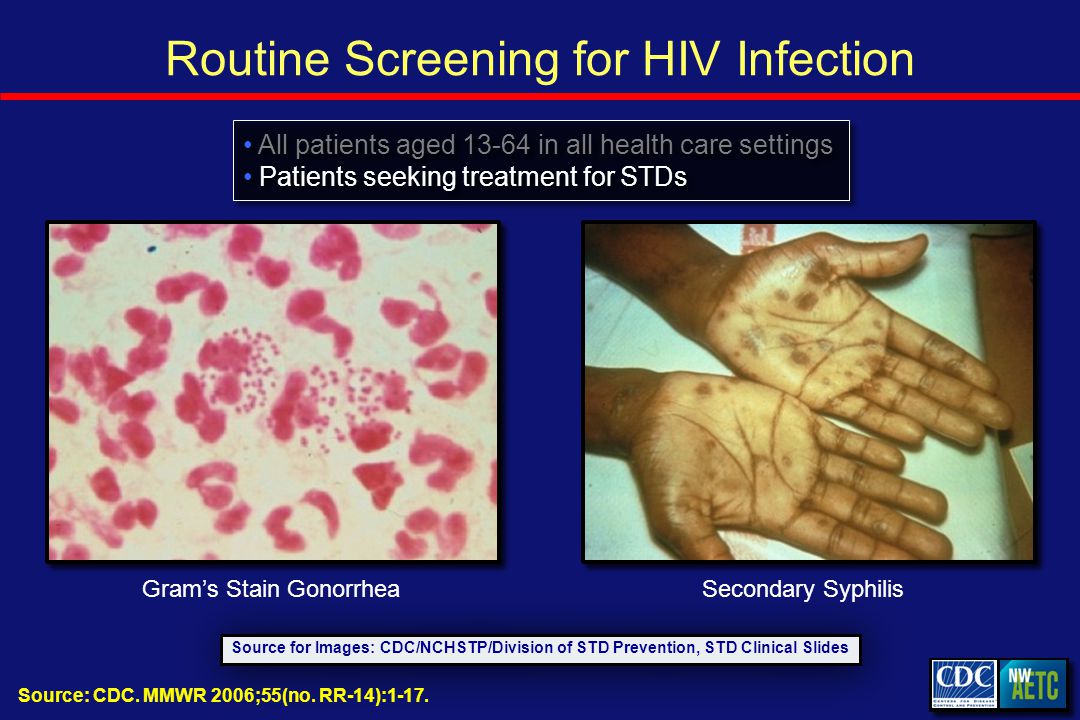 Routine Screening for HIV Infection Source for Images: CDC/NCHSTP/Division of STD Prevention, STD Clinical Slides All patients aged in all health care settings Patients seeking treatment for STDs All patients aged in all health care settings Patients seeking treatment for STDs Secondary SyphilisGram’s Stain Gonorrhea Source: CDC.