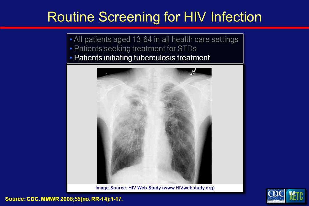 Routine Screening for HIV Infection All patients aged in all health care settings Patients seeking treatment for STDs Patients initiating tuberculosis treatment All patients aged in all health care settings Patients seeking treatment for STDs Patients initiating tuberculosis treatment Image Source: HIV Web Study (  Source: CDC.