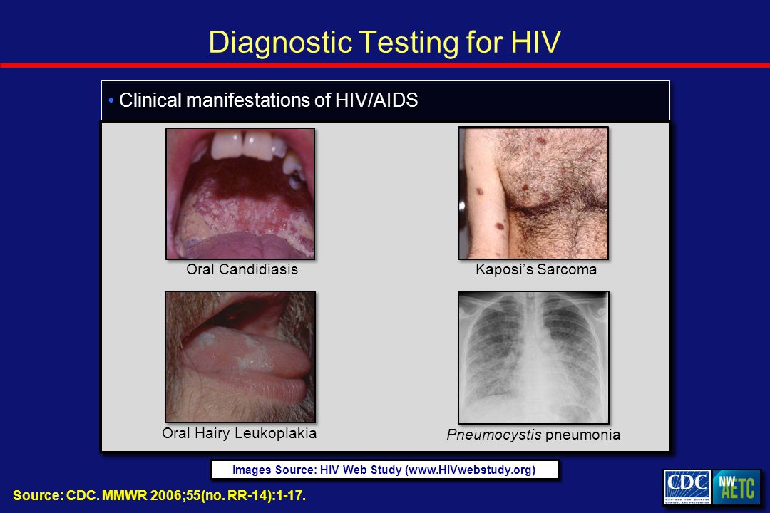 Diagnostic Testing for HIV Source: CDC. MMWR 2006;55(no.