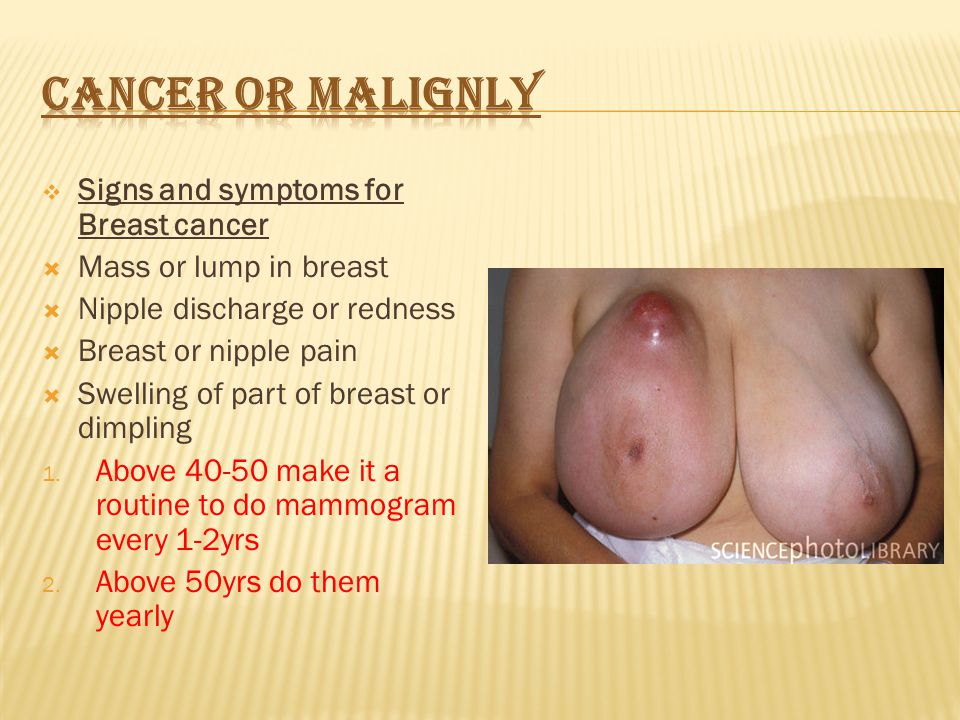  Signs and symptoms for Breast cancer  Mass or lump in breast  Nipple discharge or redness  Breast or nipple pain  Swelling of part of breast or dimpling 1.