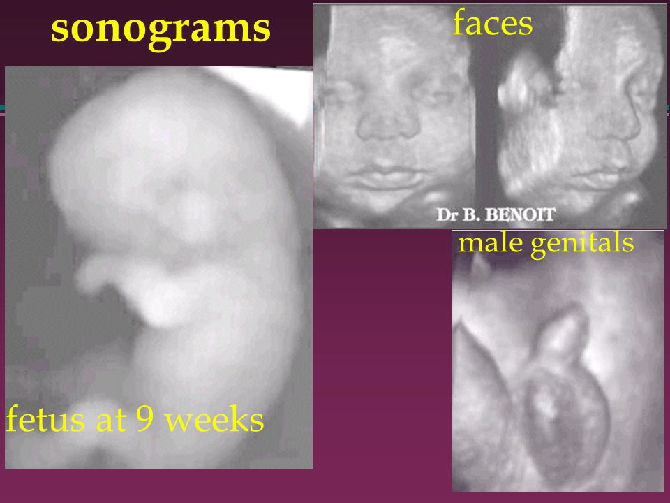 fetus at 9 weeks male genitals faces sonograms