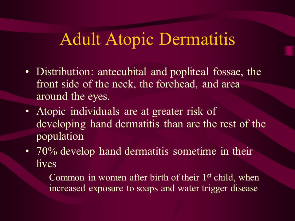 Atopic dermatitis slides