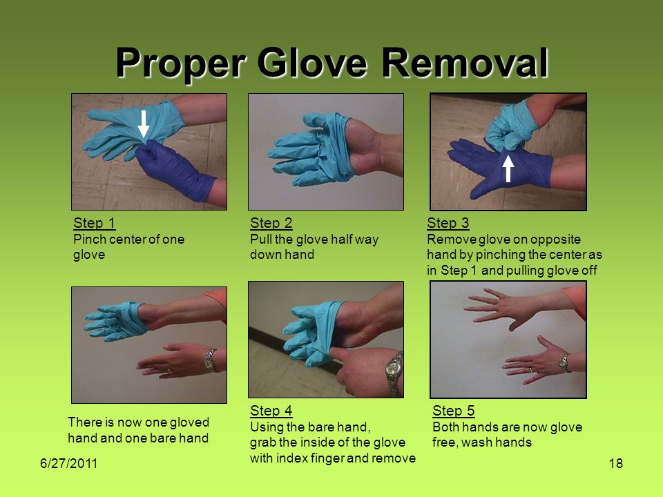 6/27/ Proper Glove Removal Step 1 Pinch center of one glove Step 2 Pull the glove half way down hand Step 3 Remove glove on opposite hand by pinching the center as in Step 1 and pulling glove off There is now one gloved hand and one bare hand Step 4 Using the bare hand, grab the inside of the glove with index finger and remove Step 5 Both hands are now glove free, wash hands