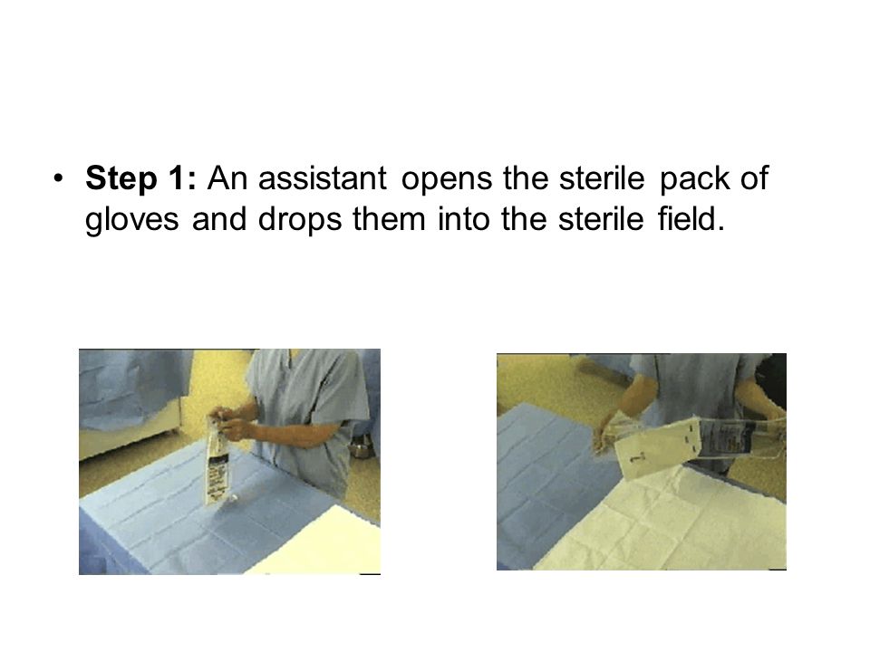 Step 1: An assistant opens the sterile pack of gloves and drops them into the sterile field.