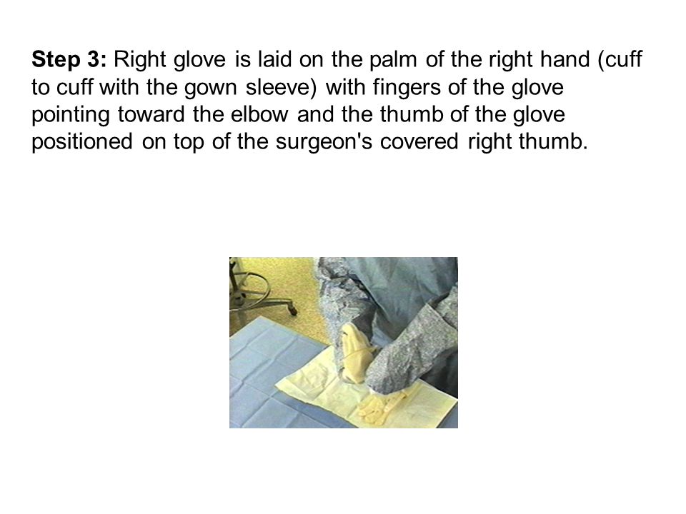 Step 3: Right glove is laid on the palm of the right hand (cuff to cuff with the gown sleeve) with fingers of the glove pointing toward the elbow and the thumb of the glove positioned on top of the surgeon s covered right thumb.