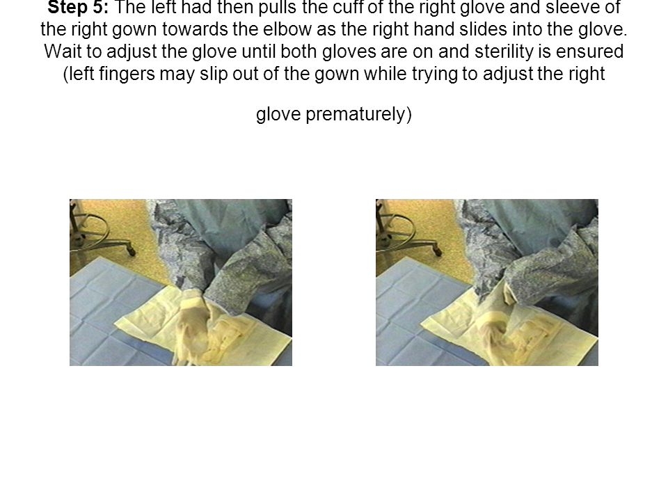 Step 5: The left had then pulls the cuff of the right glove and sleeve of the right gown towards the elbow as the right hand slides into the glove.