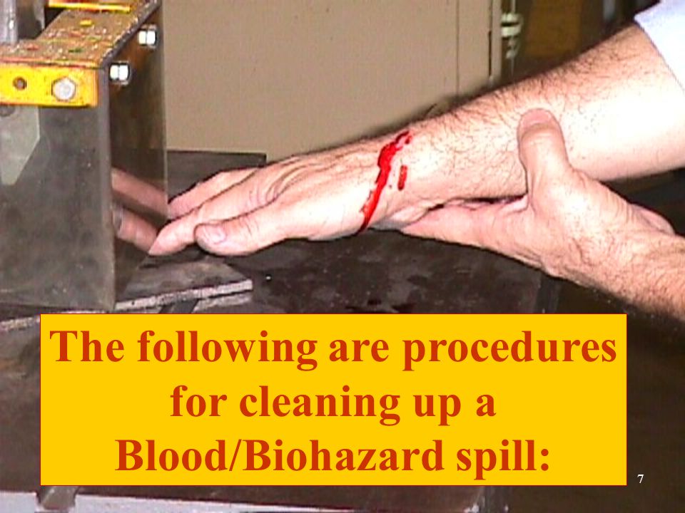7 The following are procedures for cleaning up a Blood/Biohazard spill: