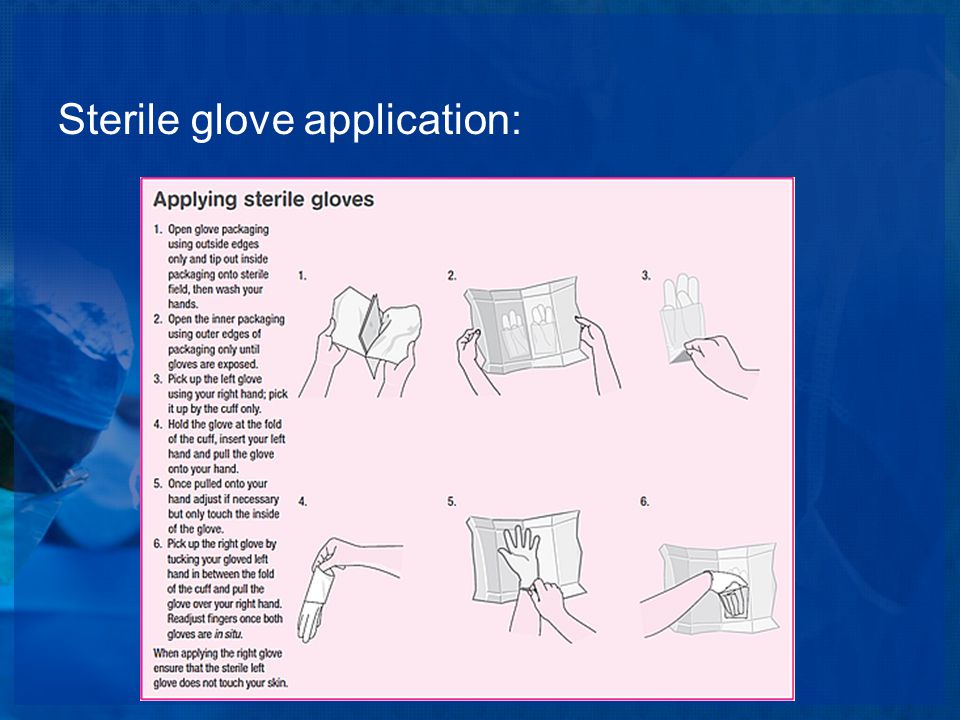 Sterile glove application: