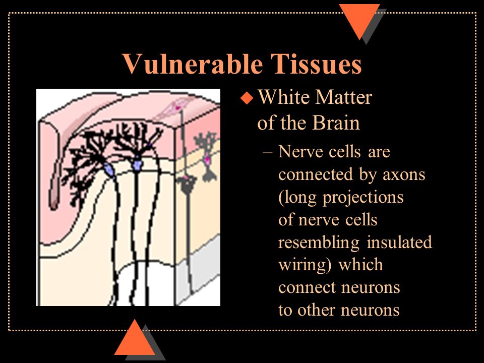 Vulnerable Tissues u White Matter of the Brain –Nerve cells are connected by axons (long projections of nerve cells resembling insulated wiring) which connect neurons to other neurons