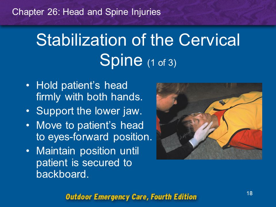 Image result for manual c spine control