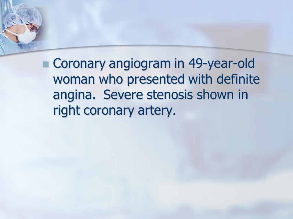 Coronary angiogram in 49-year-old woman who presented with definite angina.