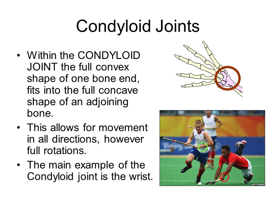 Condyloid+Joint Condyloid Joint Related Keywords & Suggestions - Condyloid Joint Long ...